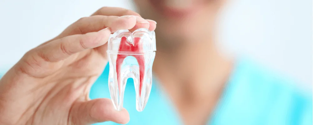 Endodoncia en Tarragona nervio