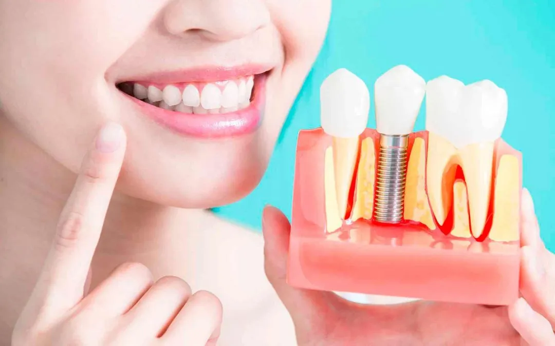 Endodoncia en Tarragona