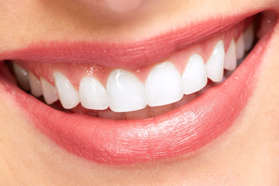 Estética dental Tarragona dientes perfectos