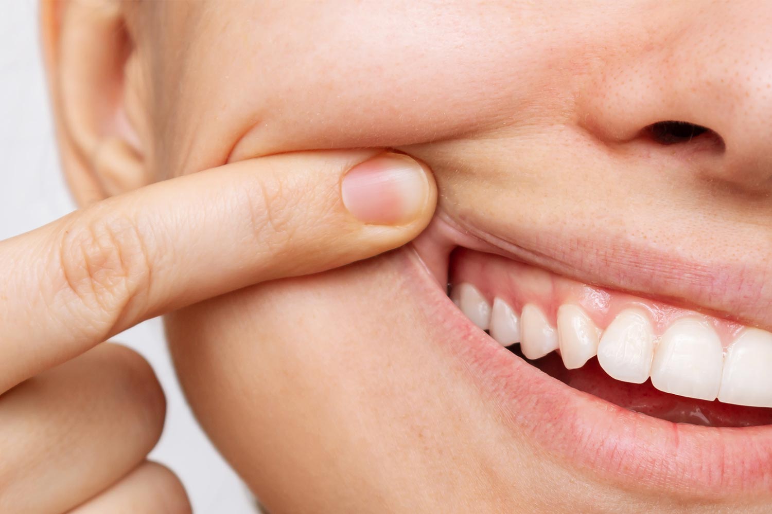 dolor de encias en Tarragona Clinica dental Rumon