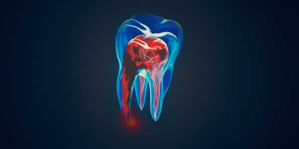 endodoncia en Tarragona