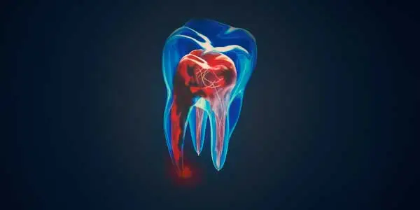 endodoncia en Tarragona