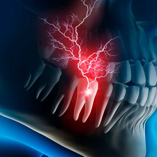 tratamiento dolor de muelas y dientes en Tarragona