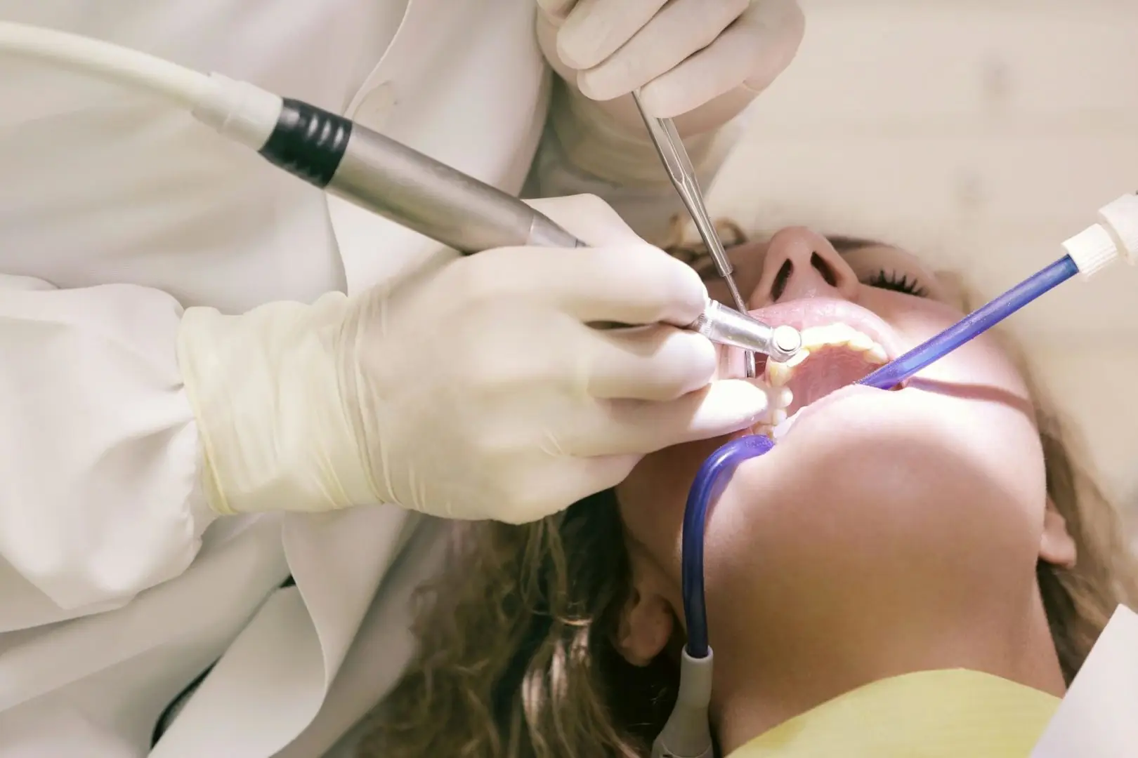 tratamiento caries en Tarragona con empastes