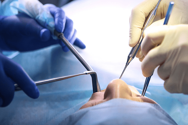 cirugía preprotesica servicios de periodoncia en tarragona 